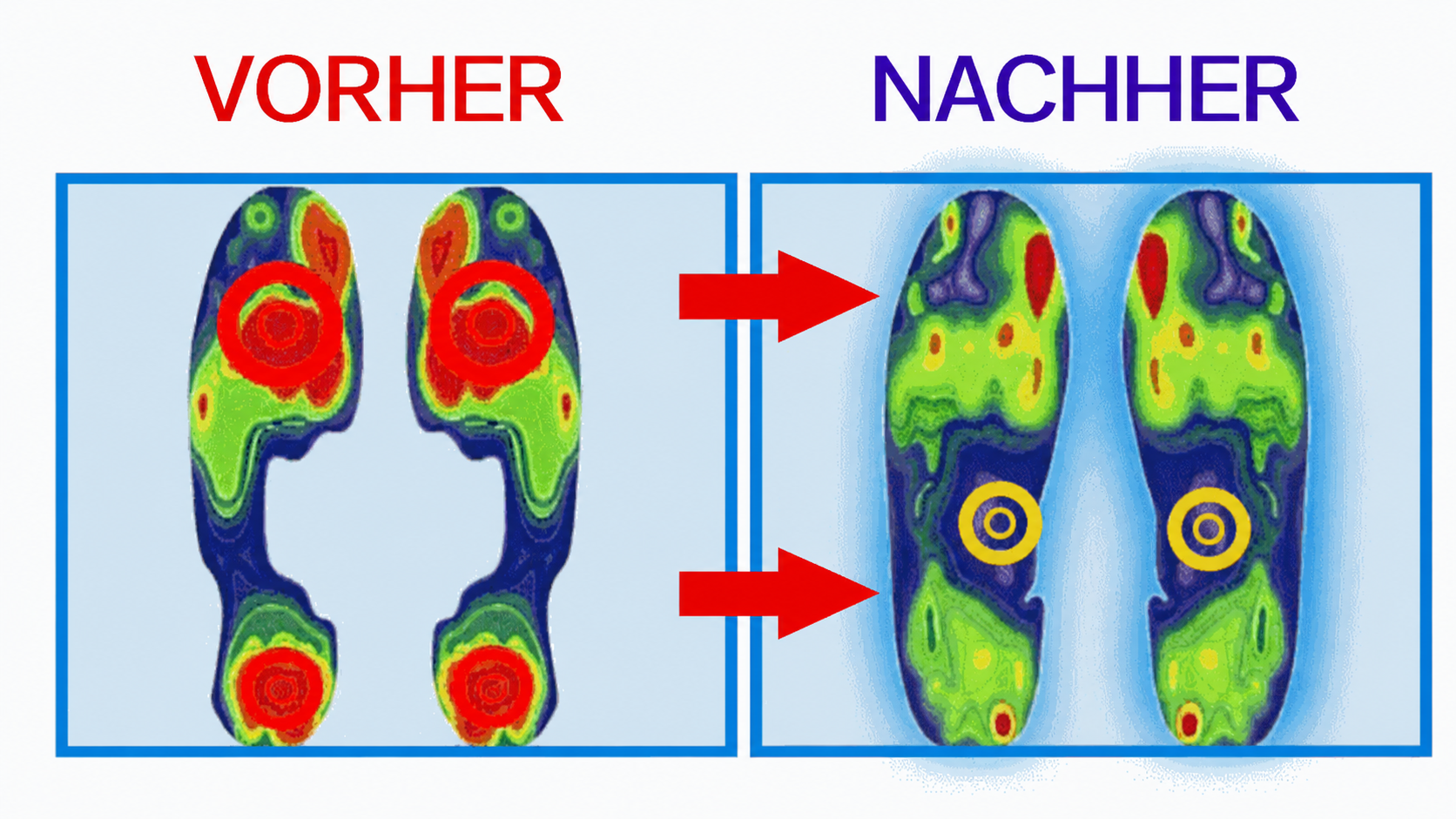 Orthopädische Römersandalen mit Mehrfachriemen