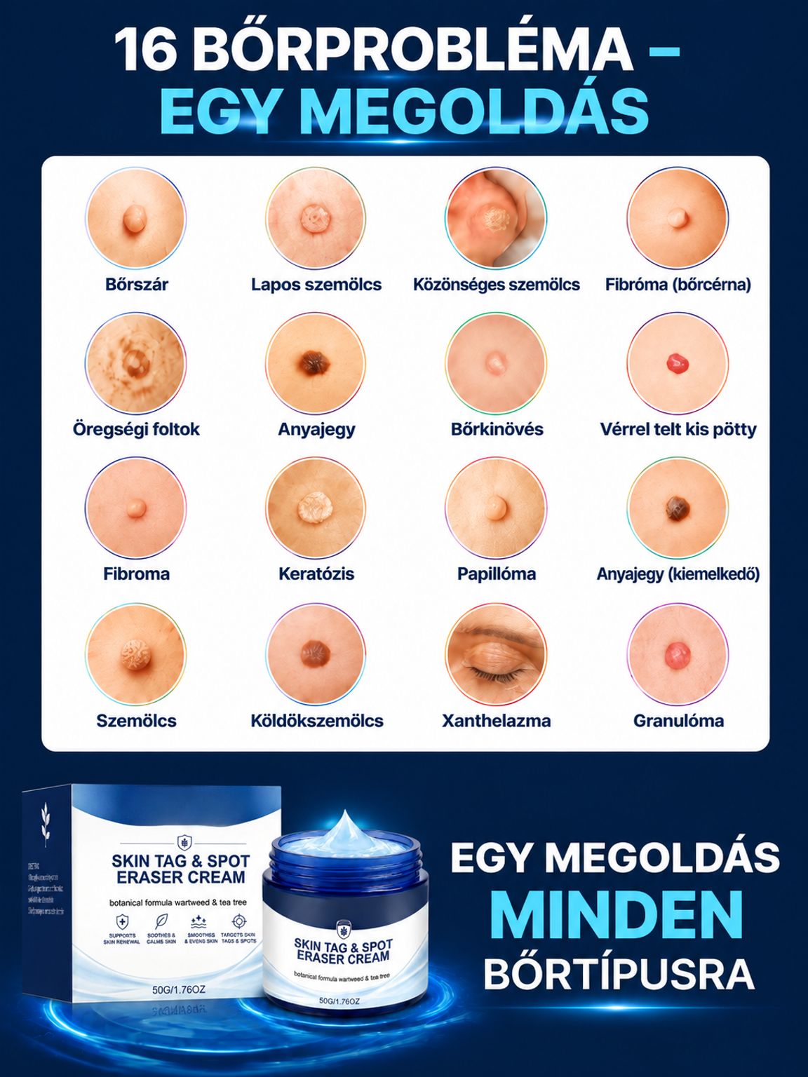  Német Formulájú Bőrhibajavító Krém | -50% Akció + Ingyenes Szállítás
