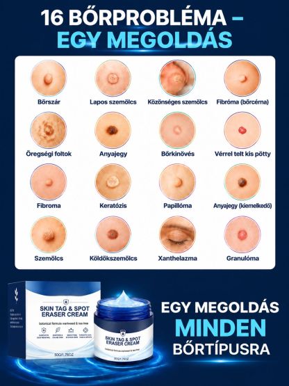  Német Formulájú Bőrhibajavító Krém | -50% Akció + Ingyenes Szállítás
