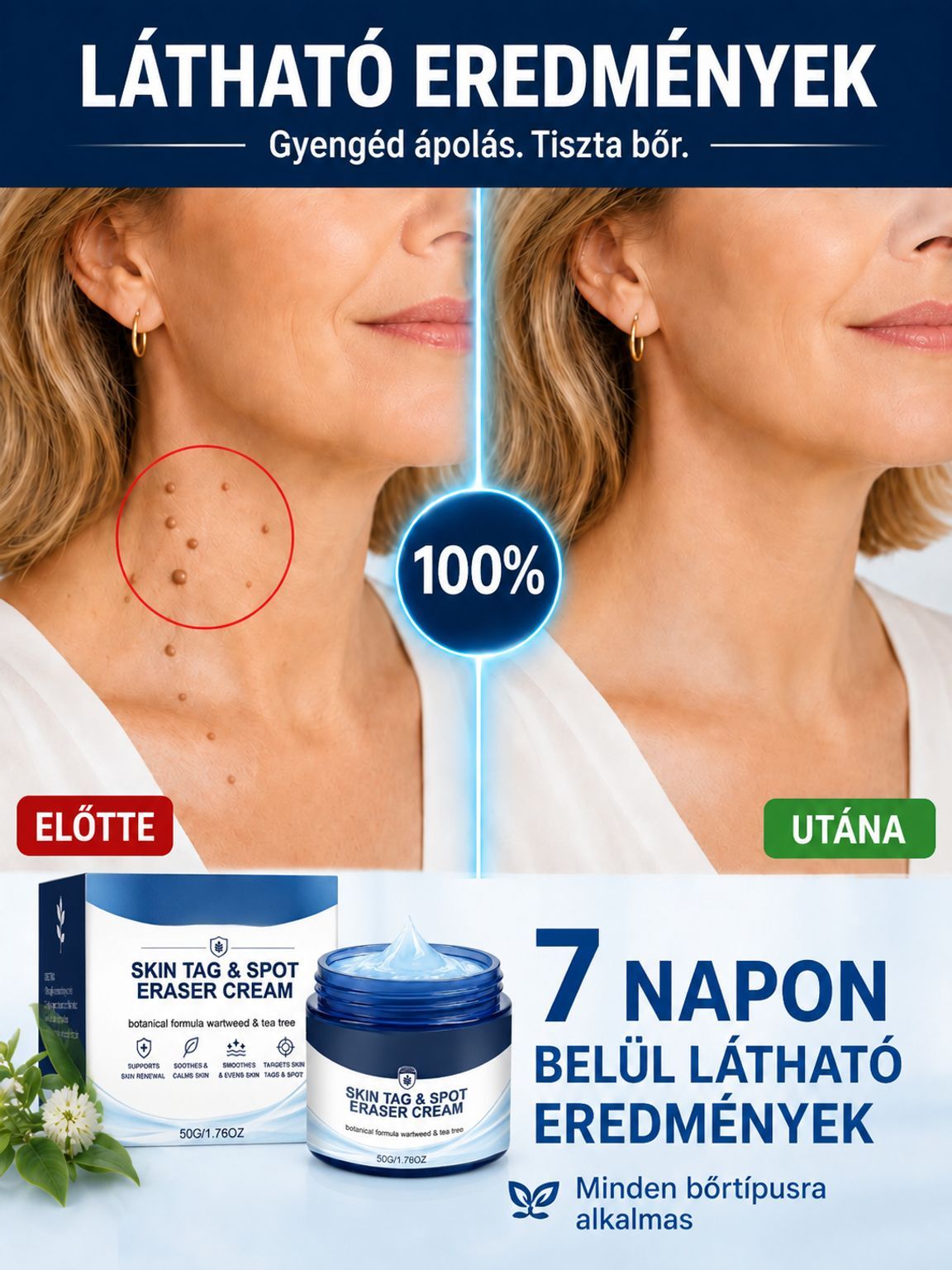  Német Formulájú Bőrhibajavító Krém | -50% Akció + Ingyenes Szállítás