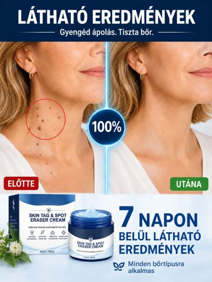  Német Formulájú Bőrhibajavító Krém | -50% Akció + Ingyenes Szállítás