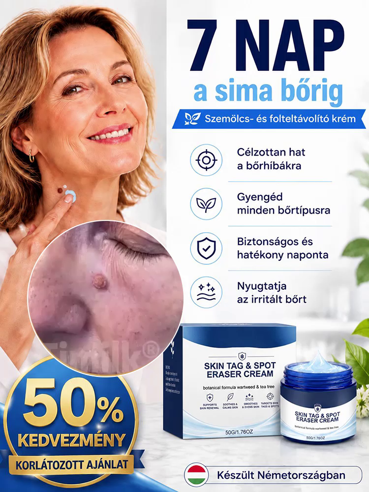  Német Formulájú Bőrhibajavító Krém | -50% Akció + Ingyenes Szállítás
