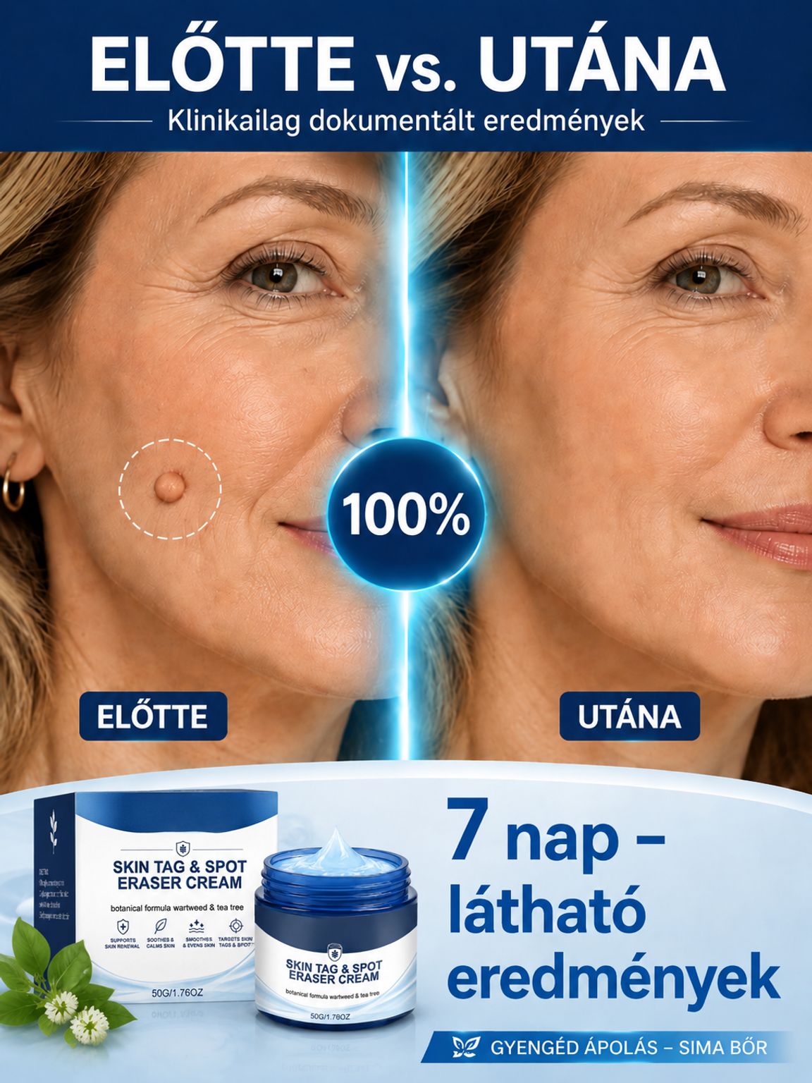  Német Formulájú Bőrhibajavító Krém | -50% Akció + Ingyenes Szállítás