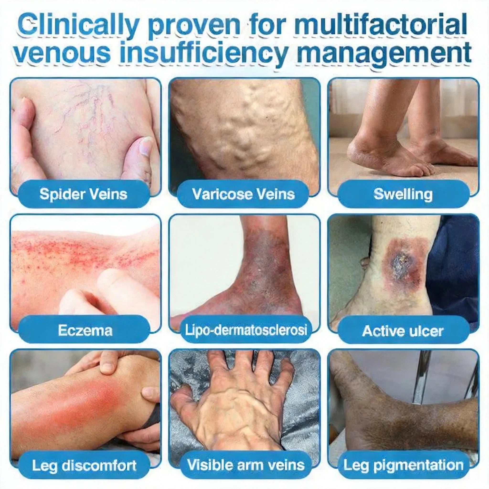Suggested leg-care application areas