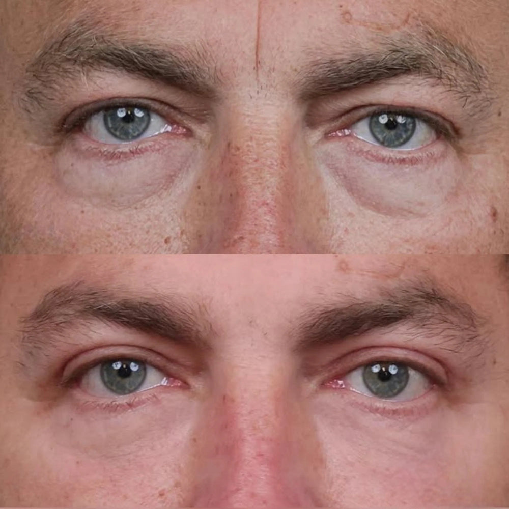 Neanes visible results timeline