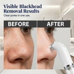 Electric Home-use Microbubble Beauty Device
