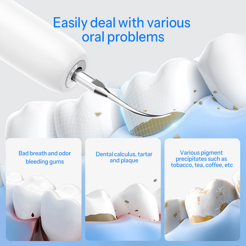 Ultrasonic Dental Cleaner For Home Use, Intelligent Ultrasonic Cleaning Device For Removing Tartar, Personal Care Dental Beauty Device