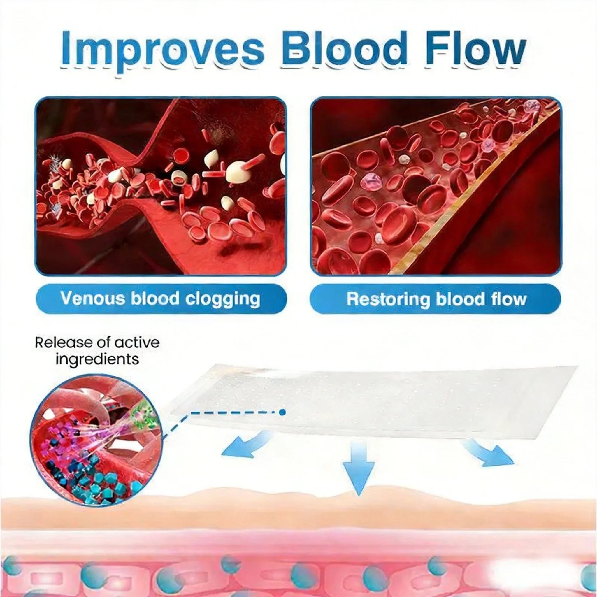 Comfortable, Breathable, And Portable Microneedle Roll-on Patches For Legs