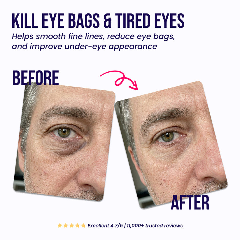 Men's Micro-needle Eye Repair Mask