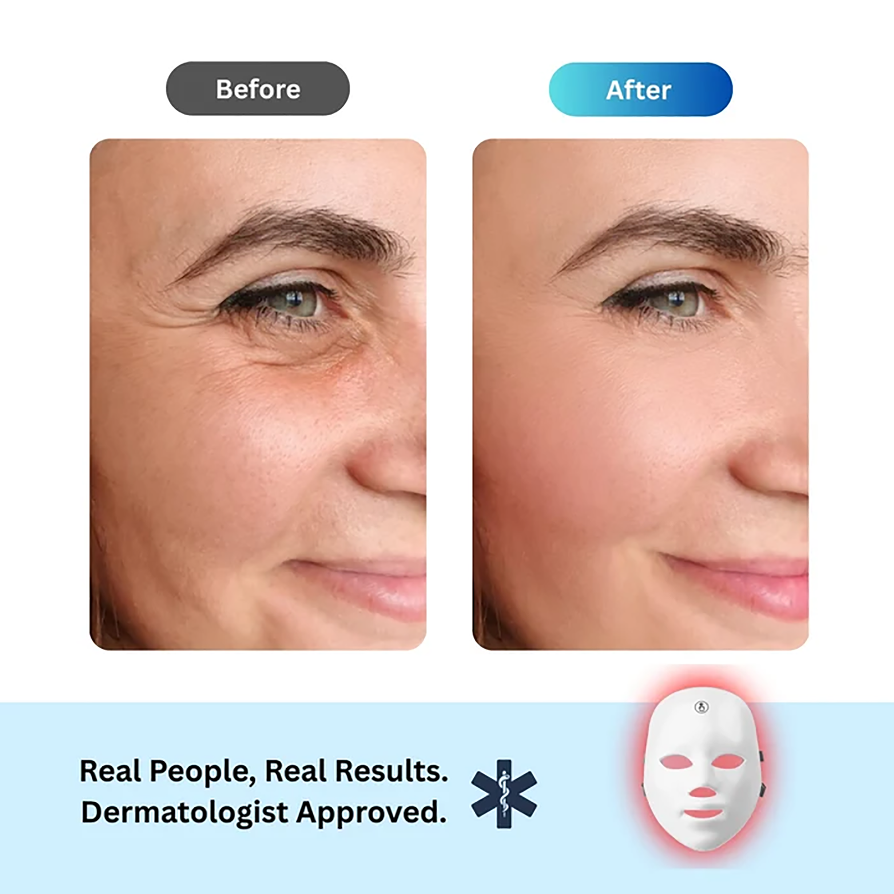 ANTI-AGING RED LIGHTMASK