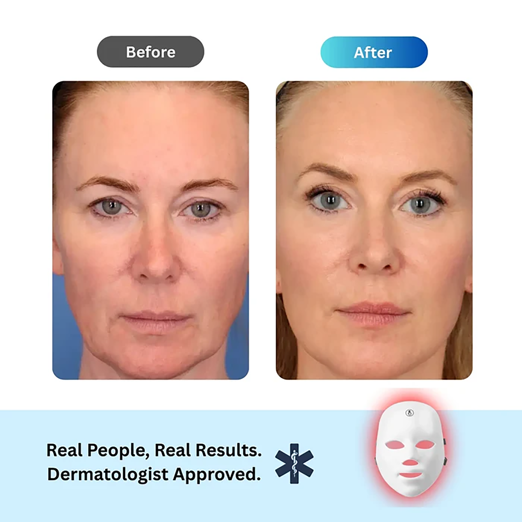ANTI-AGING RED LIGHTMASK