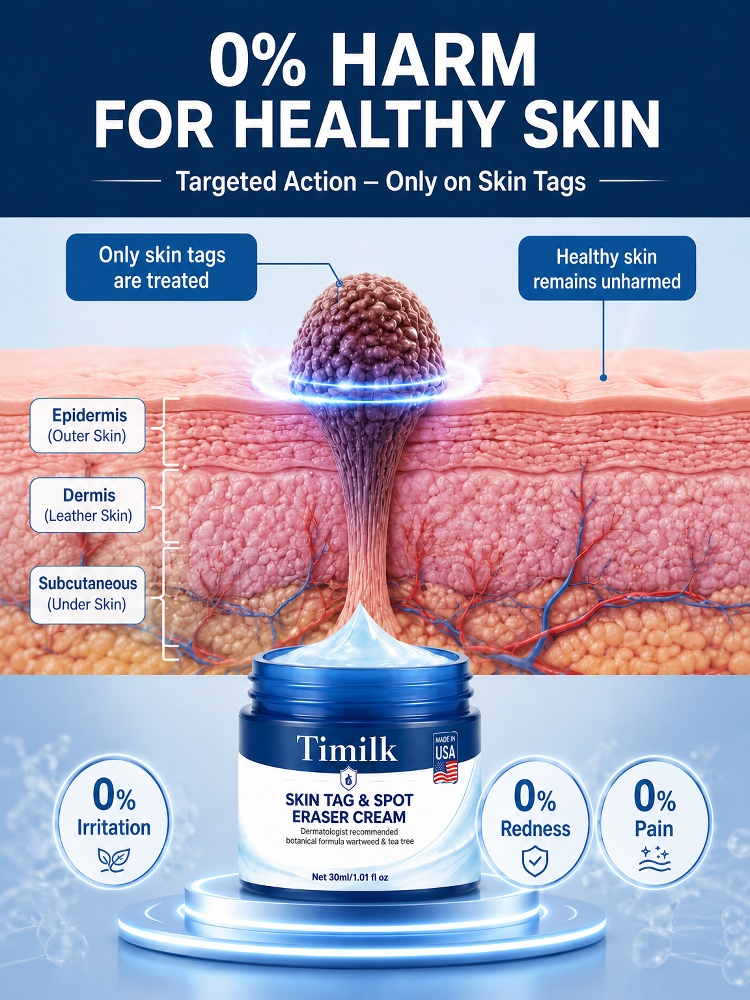 👍Advanced Smooth Skin Ointment – Painless Blemish & Tag Care (50% off)🔥