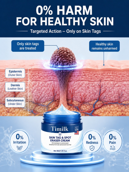 👍Advanced Smooth Skin Ointment – Painless Blemish & Tag Care (50% off)🔥