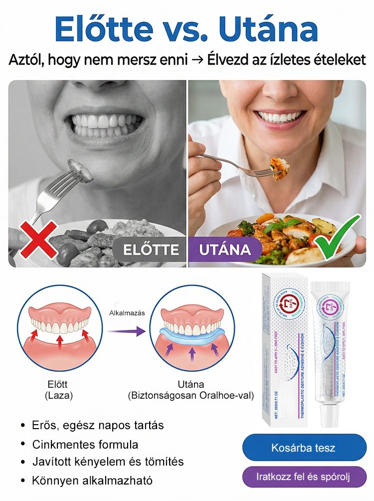 【1 Kenés = 7 Nap Tartás】100% Cinkmentes Hőplasztikus Műfogsor Párna | Zárja ki az Ételmaradékot, Harapj Bátran!