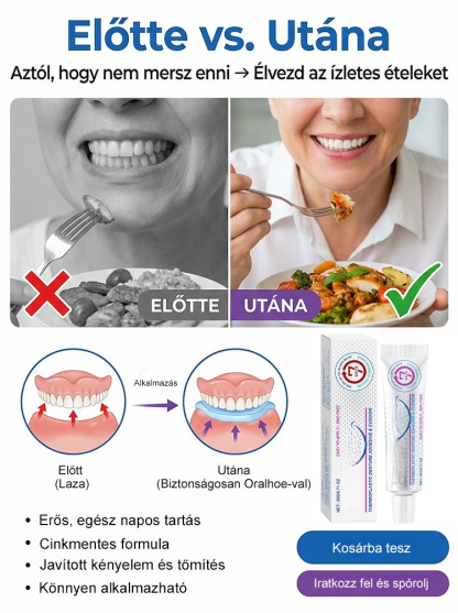 【1 Kenés = 7 Nap Tartás】100% Cinkmentes Hőplasztikus Műfogsor Párna | Zárja ki az Ételmaradékot, Harapj Bátran!