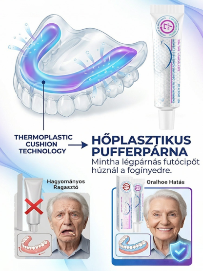 【1 Kenés = 7 Nap Tartás】100% Cinkmentes Hőplasztikus Műfogsor Párna | Zárja ki az Ételmaradékot, Harapj Bátran!