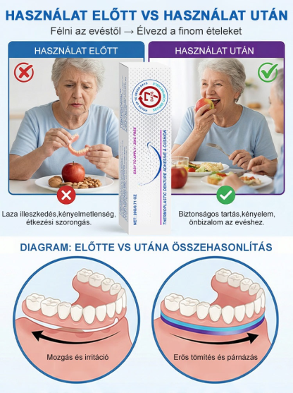 【1 Kenés = 7 Nap Tartás】100% Cinkmentes Hőplasztikus Műfogsor Párna | Zárja ki az Ételmaradékot, Harapj Bátran!