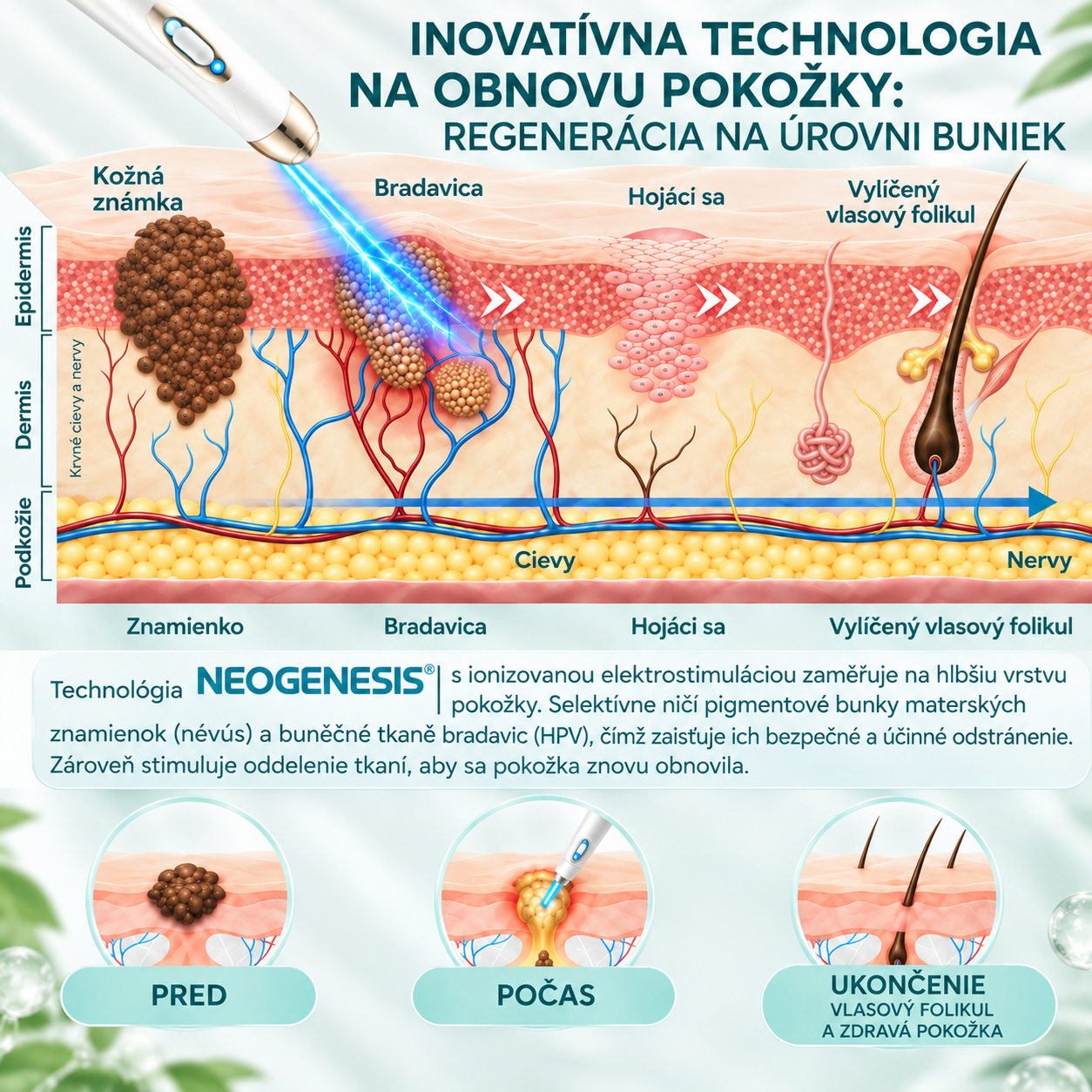 ✨ NEOGENESIS™ 2026 – Multifunkčná starostlivosť o pleť novej generácie v pere: profesionálne riešenie na odstránenie znamienok a nedokonalostí. Neinvazívna technológia bez bolesti a bez jaziev pre zdravšiu a žiarivejšiu pleť. Vyrobené v USA. ✨
