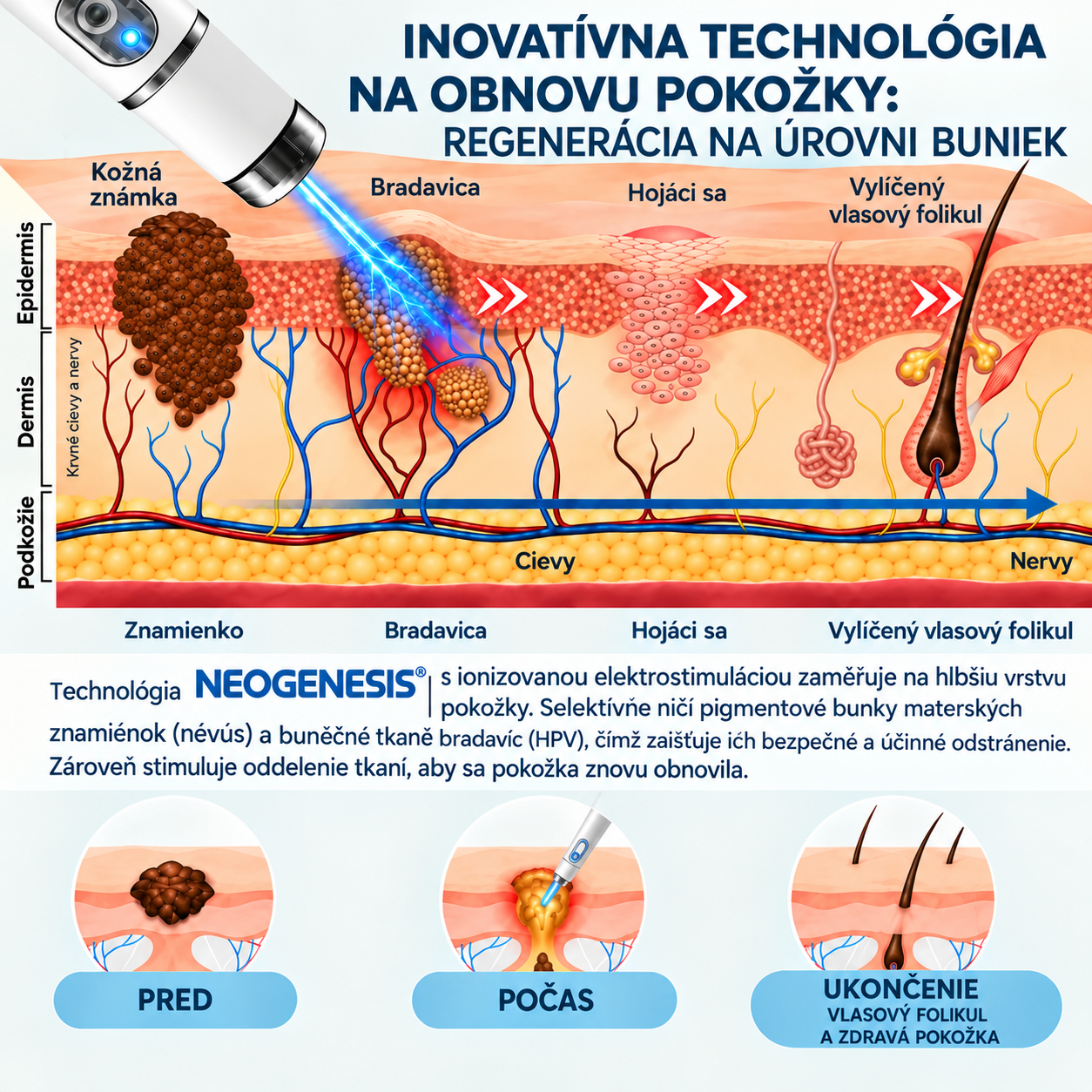 ✨ NEOGENESIS™ 2026 – Multifunkčná starostlivosť o pleť novej generácie v pere: profesionálne riešenie na odstránenie znamienok a nedokonalostí. Neinvazívna technológia bez bolesti a bez jaziev pre zdravšiu a žiarivejšiu pleť. Vyrobené v USA. ✨