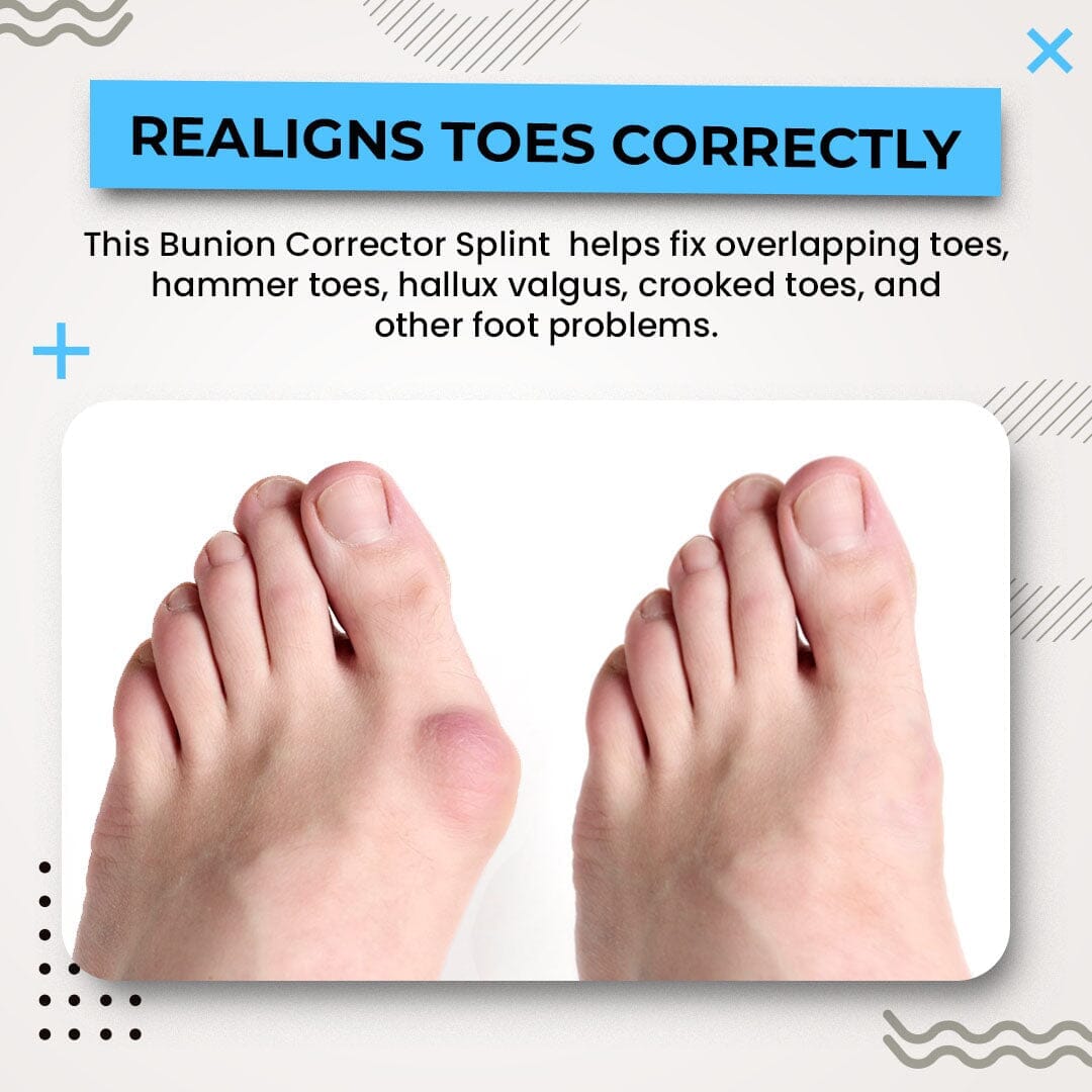Alayna™ 3D Bunion Splint Corrector🦶