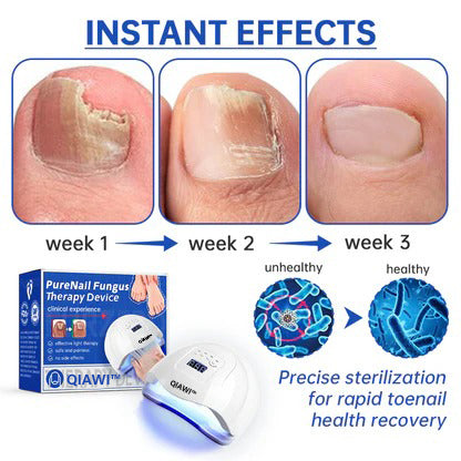 🔥 Father's Day Sale👏QIAWI™ PureNail Fungus Laser Device-✨Last Day Discount -50%𝐎𝐅𝐅