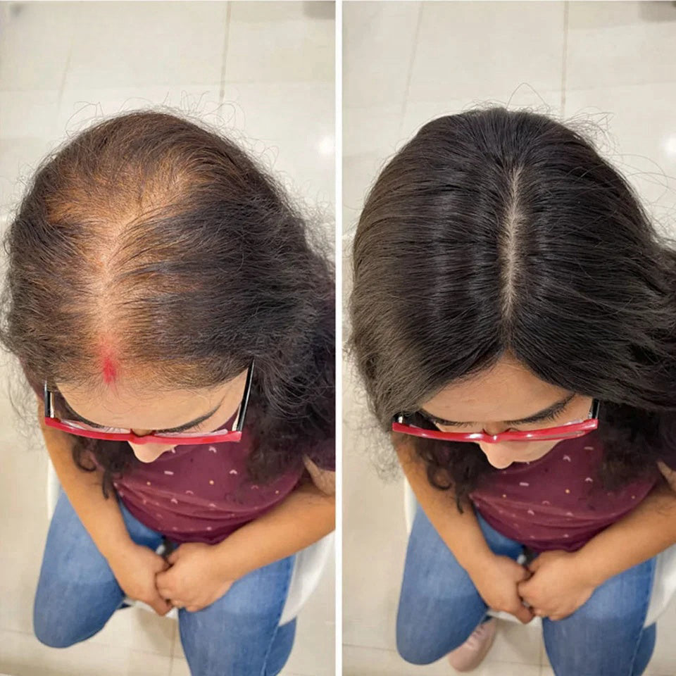 Womens Hair Topper with Clips  Hair Toppers for Thin Hair WomenColor Clip In One Piece Hair Extensions