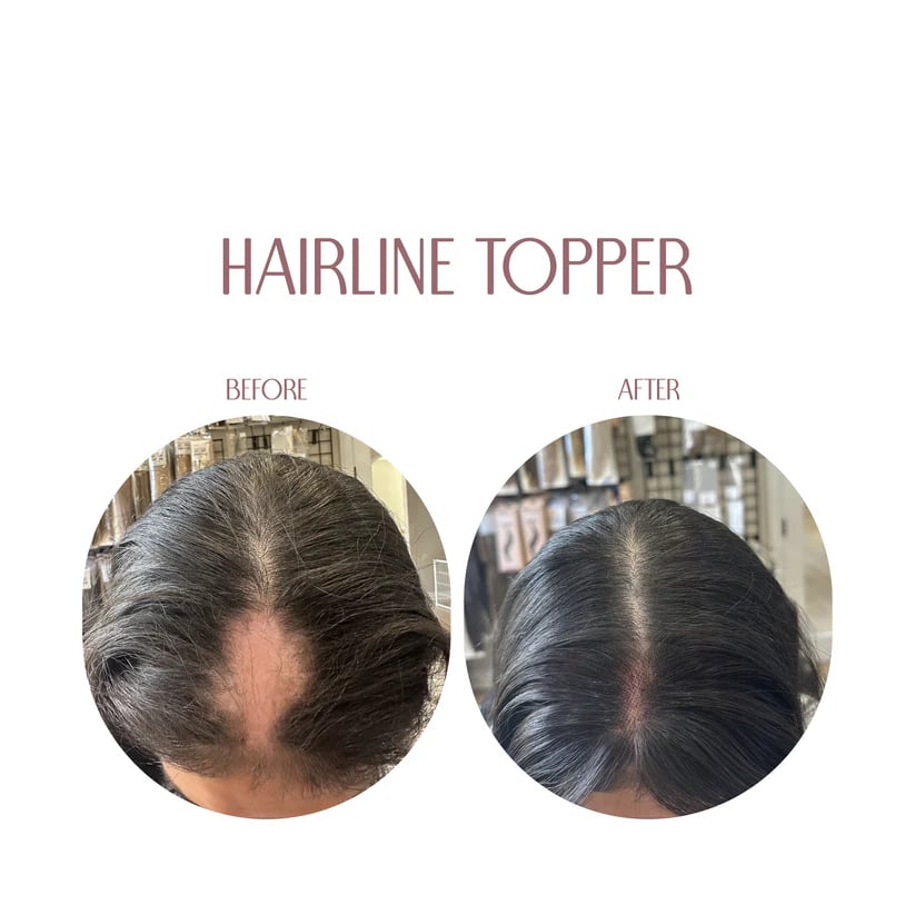 🔥 🎀New Hairline Human Topper