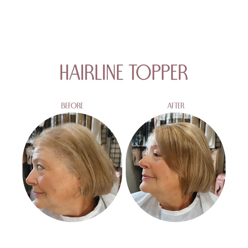 🔥 🎀New Hairline Human Topper