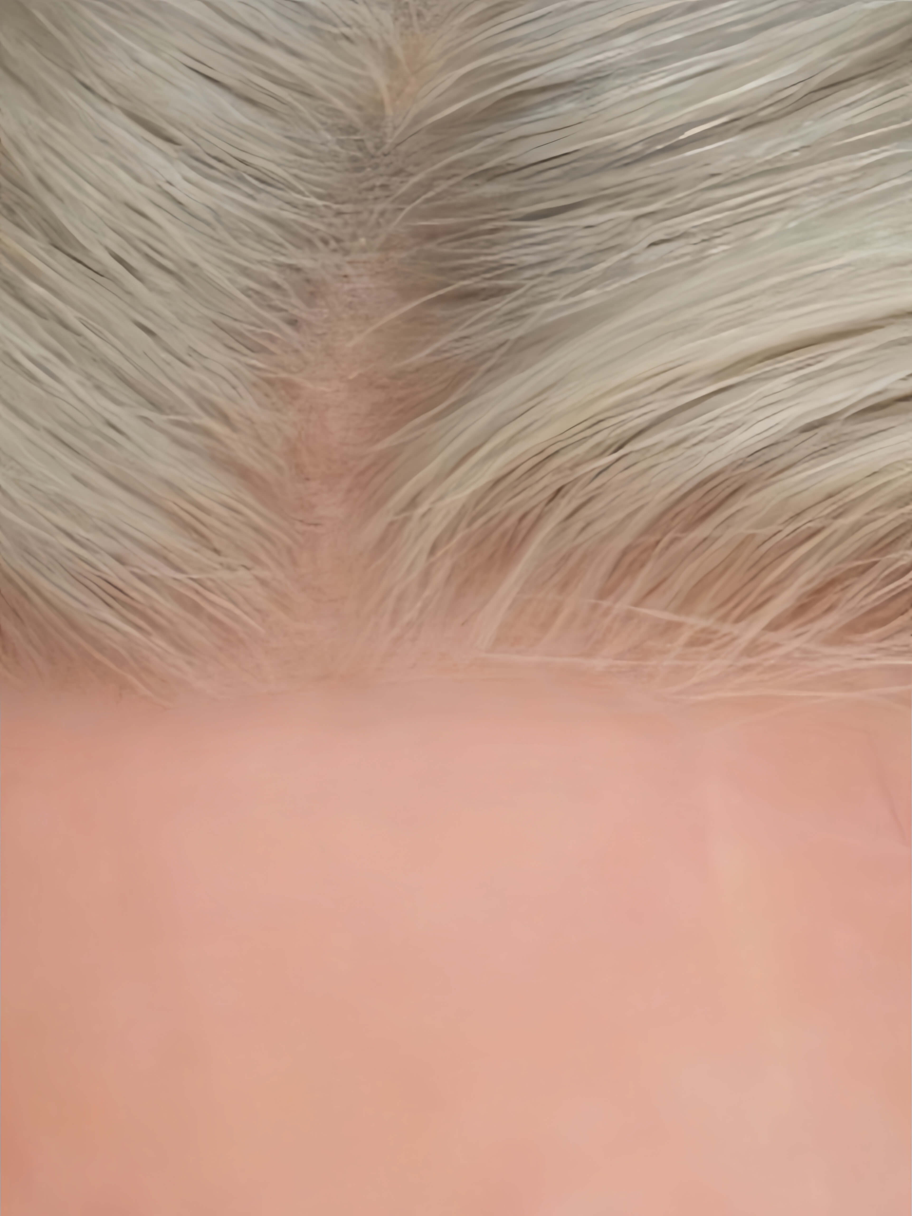 Purewig Ayla 18" |  BioLace Top Remy Human Hair Wig- Pearl Platinum Blonde with Shadow Root