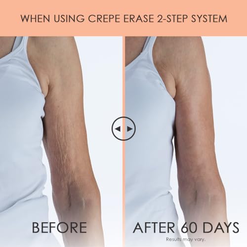 Crepe Erase 2-Step Advanced Body Care Treatment, Anti-Aging Skin Care for Body/Neck, Firming Moisturizer Cream + Body Exfoliating Pre-Treatment, Supports Wrinkle, Crepe Skin, Collagen