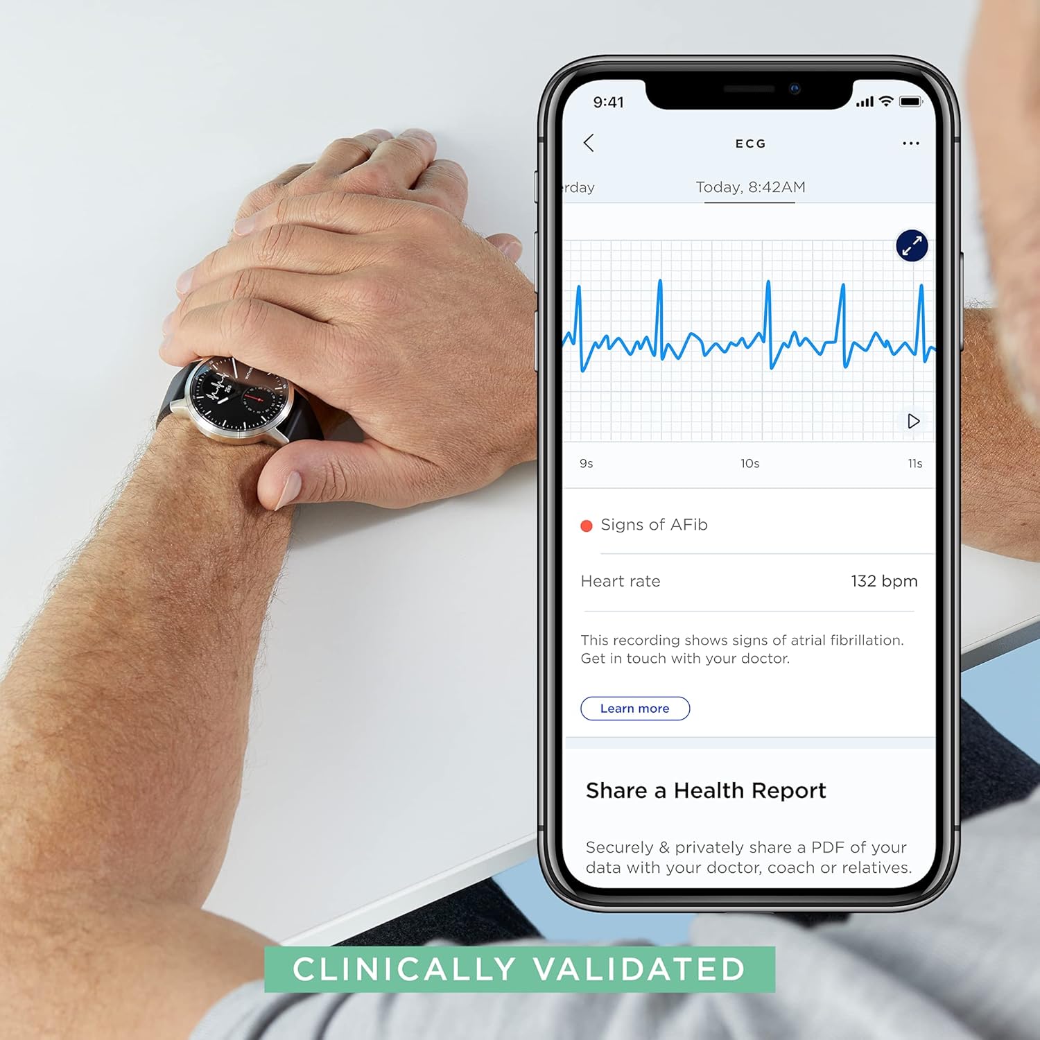 Withings ScanWatch - Hybrid Smartwatch with ECG, Heart Rate Sensor and Oximeter (White, 42mm)