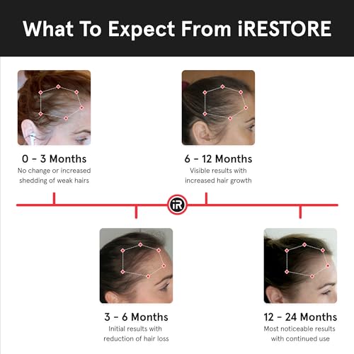 iRestore Essential Laser Hair Growth System - FDA Cleared Hair Growth for Men & Hair Loss Treatments for Women with Thinning Hair, Hair Regrowth for Women