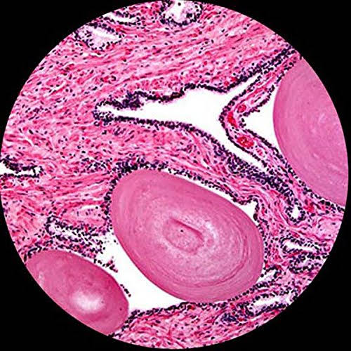 Amscope 40X-2500X LED Digital Binocular Compound Microscope W 3D Stage + 5MP USB Camera