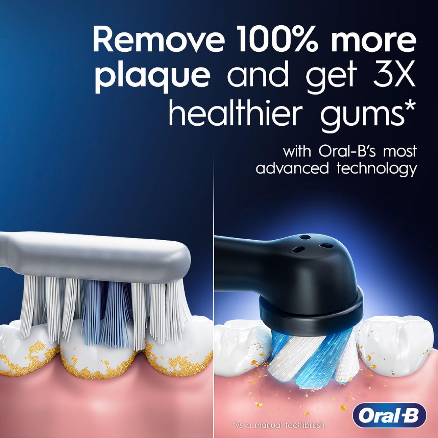 Oral-B iO Series 7 Electric Toothbrush with 5 Replacement Brush Heads, Black Onyx
