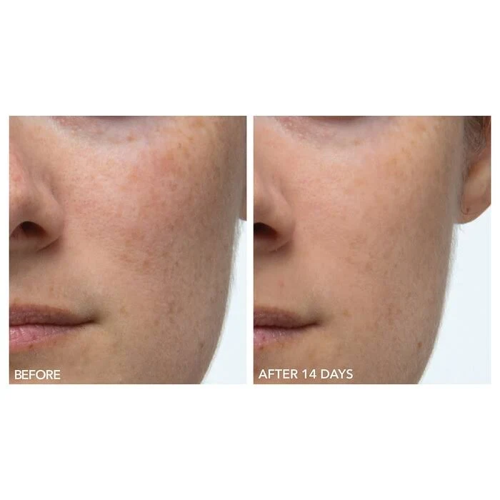 Dr. Dennis Gross Skincare Alpha Beta Extra Strength Daily Peel 60 Treatments