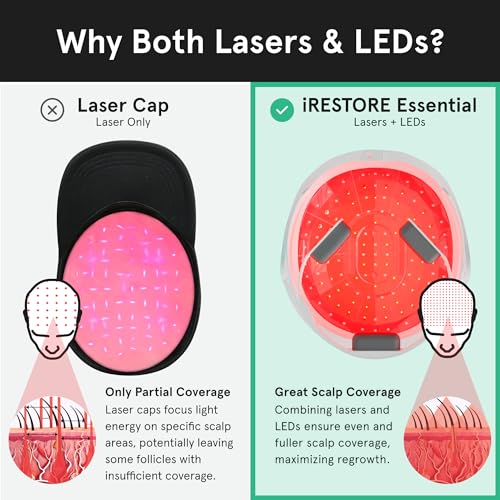 iRestore Essential Laser Hair Growth System - FDA Cleared Hair Growth for Men & Hair Loss Treatments for Women with Thinning Hair, Hair Regrowth for Women