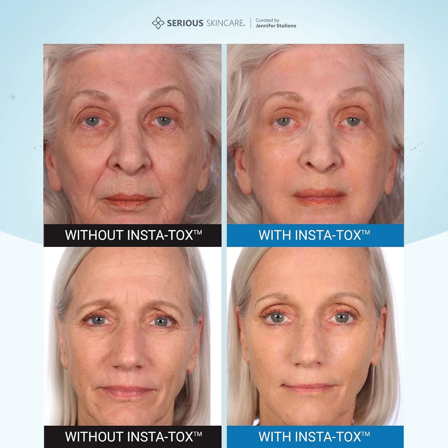 Serious Skincare INSTA-TOX Instant Wrinkle Smoothing Serum - Temporarily Tightens Skin - Instant Line Filler - Improves appearance of Fine Lines & Wrinkles -Two .75 oz. Tubes (2Pack) Pack of 2