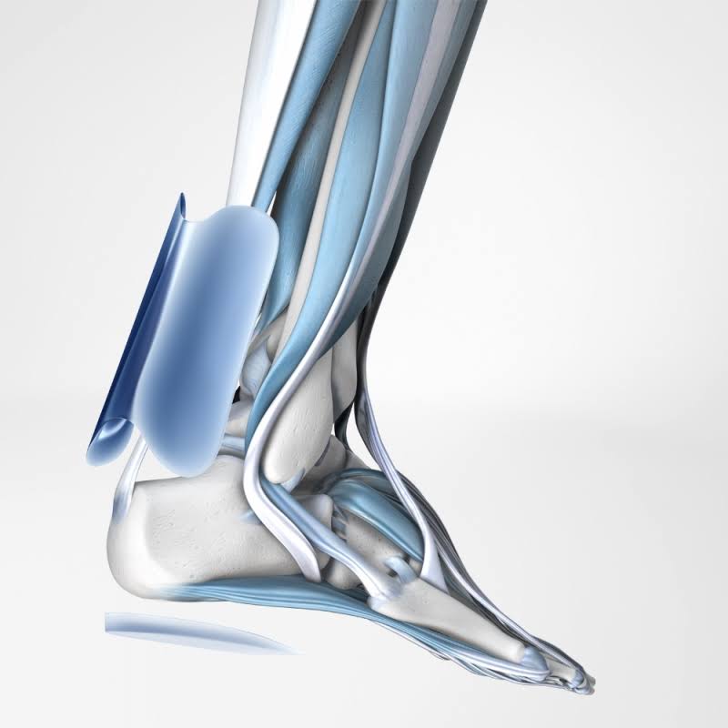 Bauerfeind - AchilloTrain Achilles Tendon Support