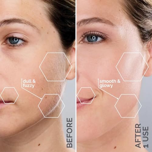 Michael Todd Beauty Sonicsmooth Pro+ Dermaplane Razor for Women Face + Eyebrow trimmer Dermaplaning System w/LED Light Peach Fuzz Remover -16 Dermaplaning Blades & 2 Microsmooth Exfoliation Tips