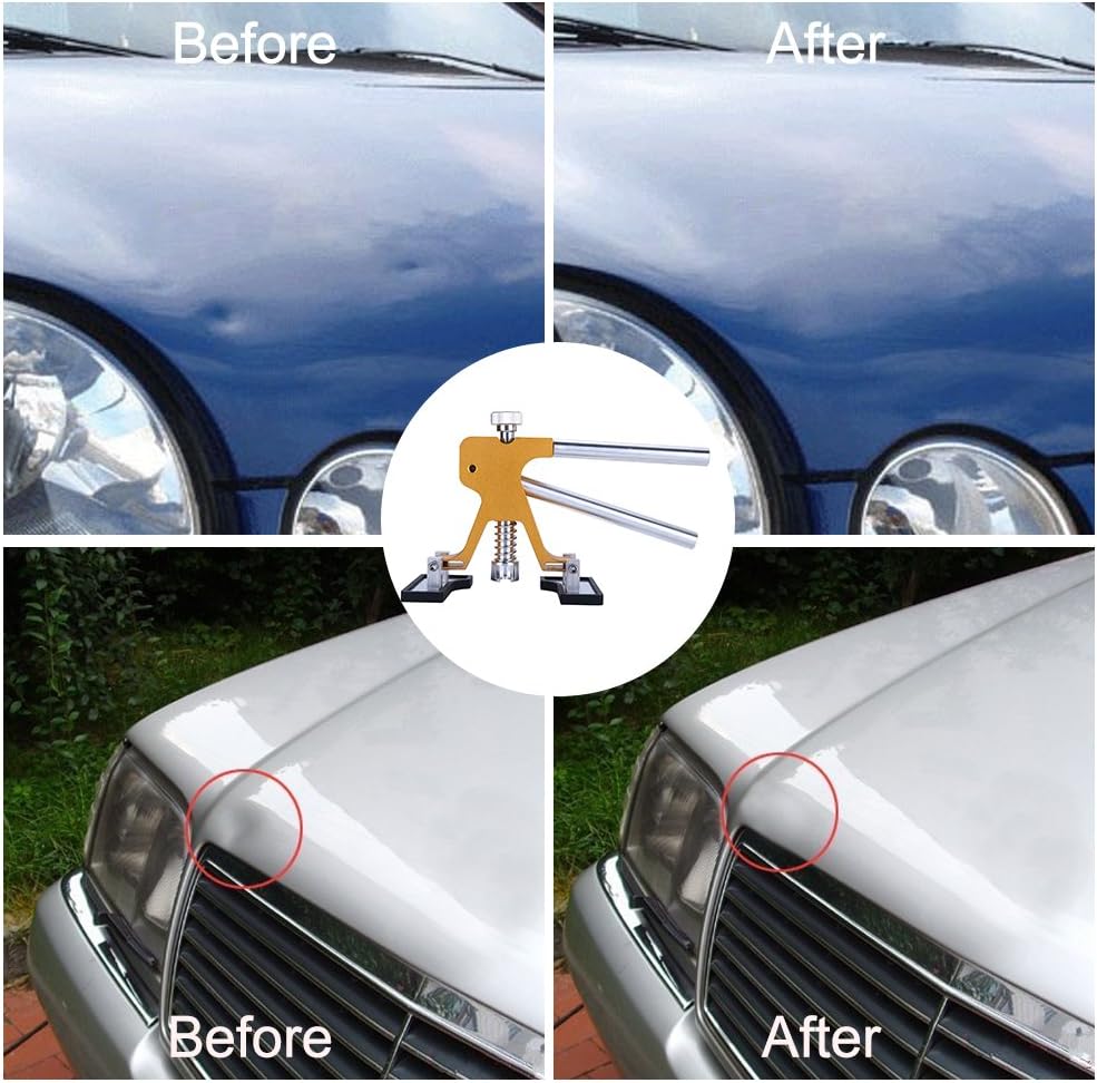 Gliston Auto Dent Puller Kit - Adjustable Golden Dent Remover Tools Paintless Dent Repair Kit Dent Lifter Puller for Car Large & Small Ding Hail Dent Removal