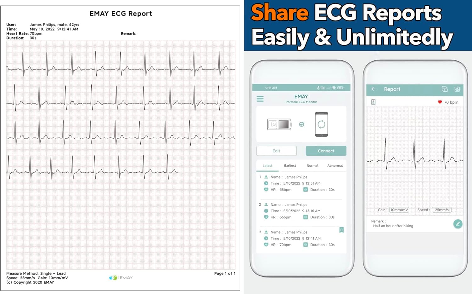 EMAY Portable ECG Monitor | Record ECG and Heart Rate | Compatible with Smartphone and PC (Grey)