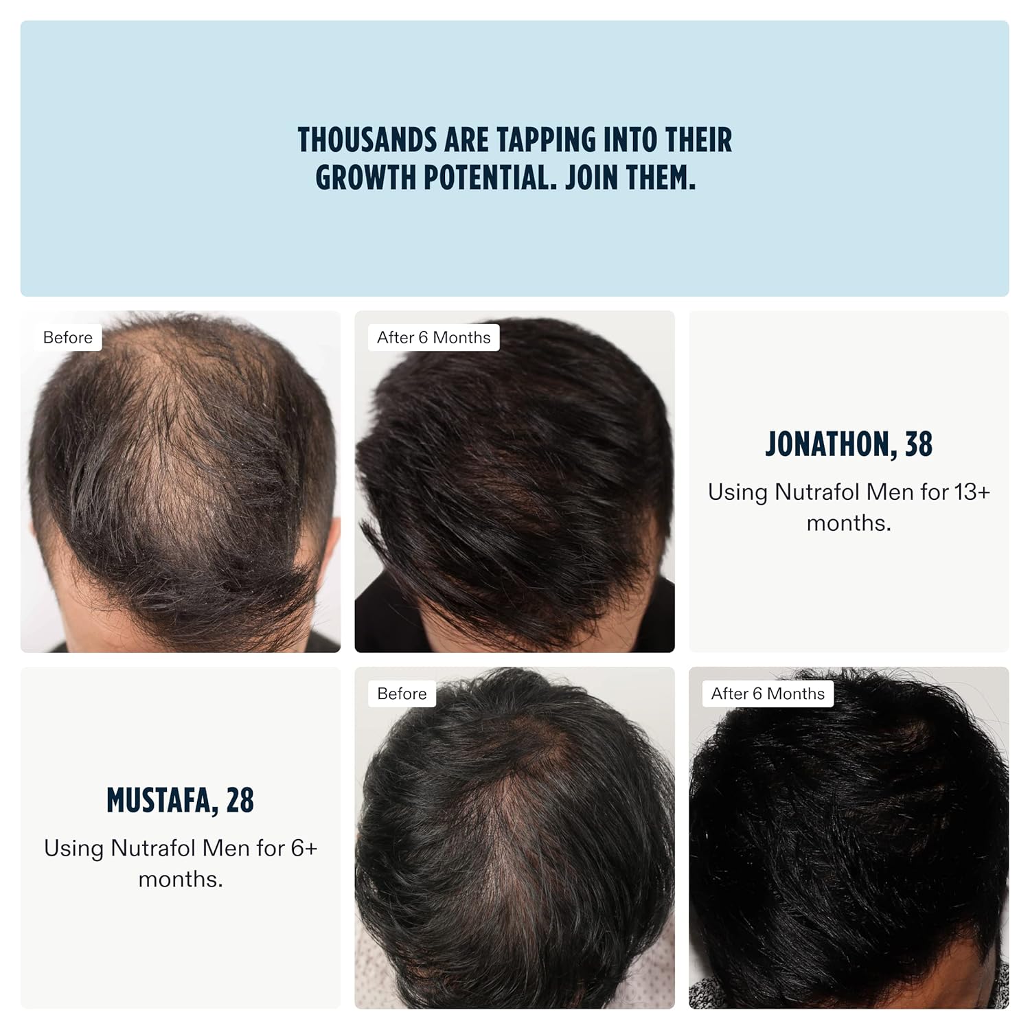Nutrafol Men's Hair Growth Supplement, Clinically Proven for Thicker-Looking, Stronger-Feeling Hair and More Scalp Coverage (2-Month Supply)