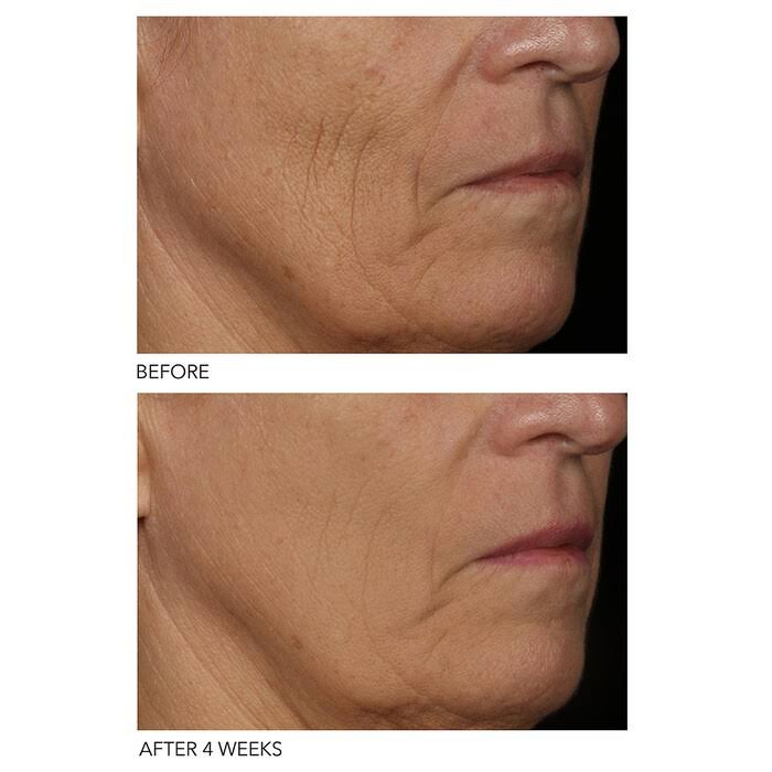 Dr Dennis Gross Skincare DRX Spectralite Faceware Pro 2024 Best Sellers