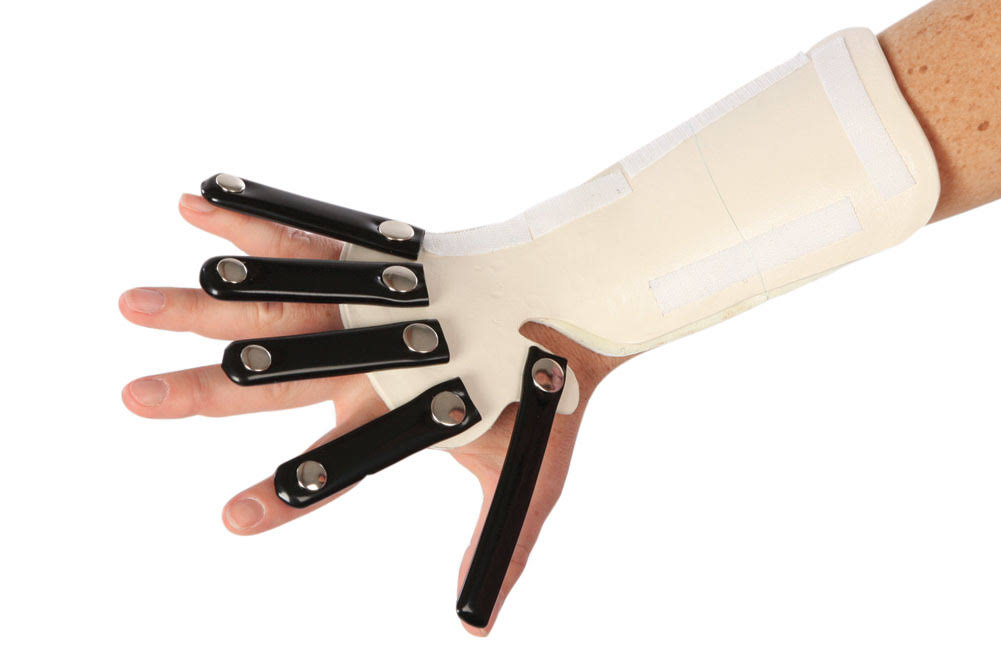 Robinson Forearm-Based Radial Nerve Splint, Right, Extra Large