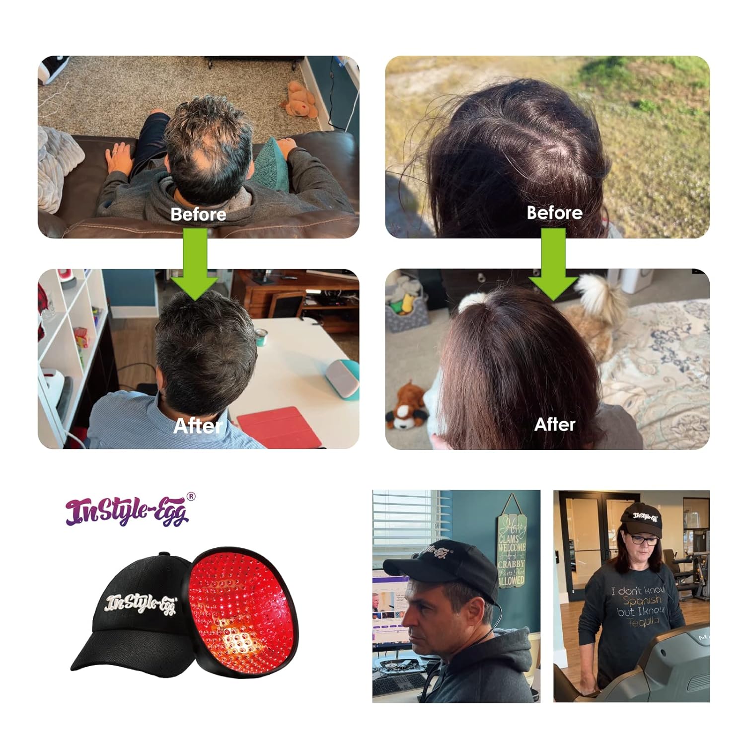 Laser Cap for Hair Growth with 80 Medical Grade Lasers, FDA Cleared Low Level Laser Therapy, Hair Regrowth System for Men and Women