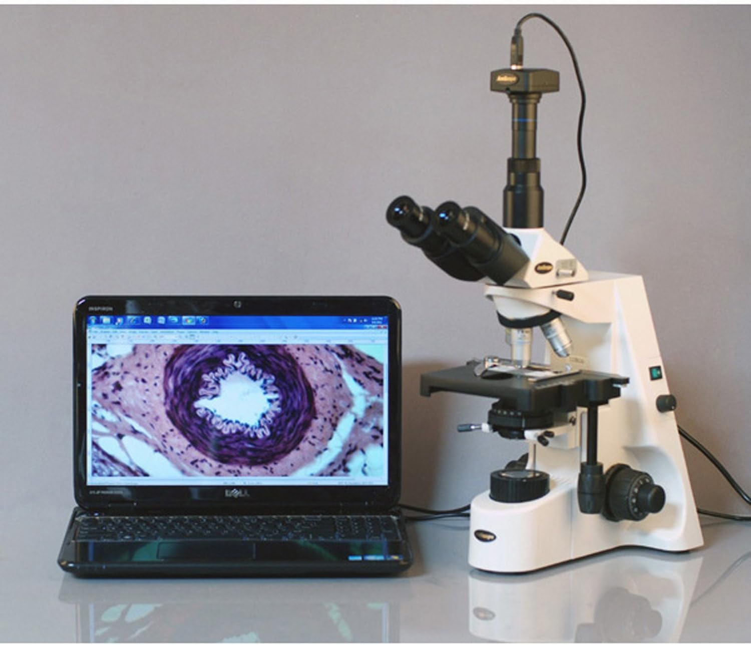 AmScope T690C-5M Digital Trinocular Compound Microscope, 40X-2500X Magnification, WH10x and WH25x Super-Widefield Eyepieces, Infinity Objectives, Brightfield, Kohler Condenser, Double-Layer Mechanical Stage, Includes 5MP Camera with Reduction Lens an