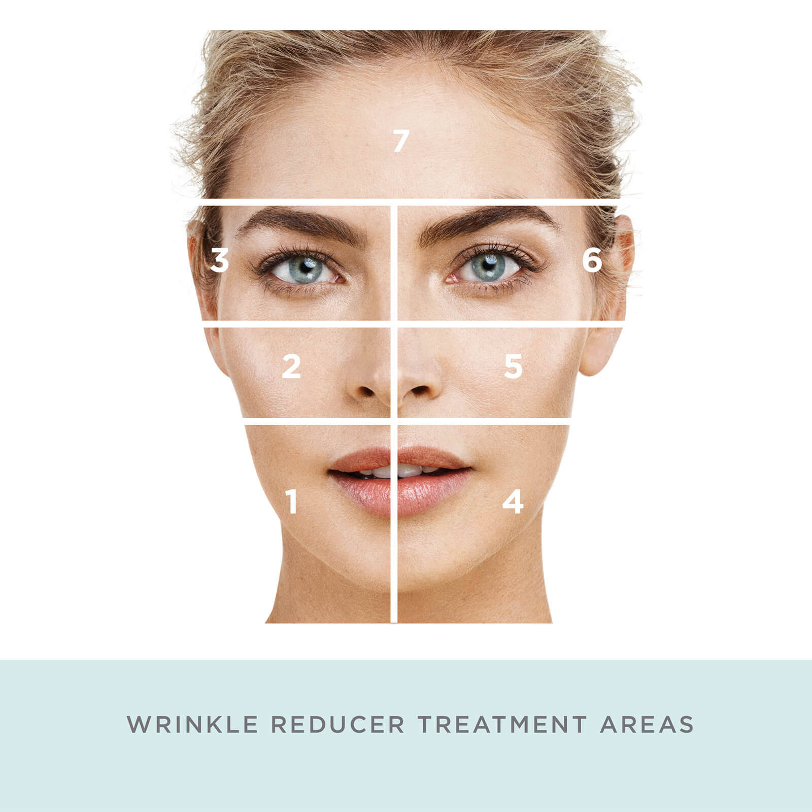 NuFACE Trinity Facial Trainer Kit with Wrinkle Reducer Attachment, White