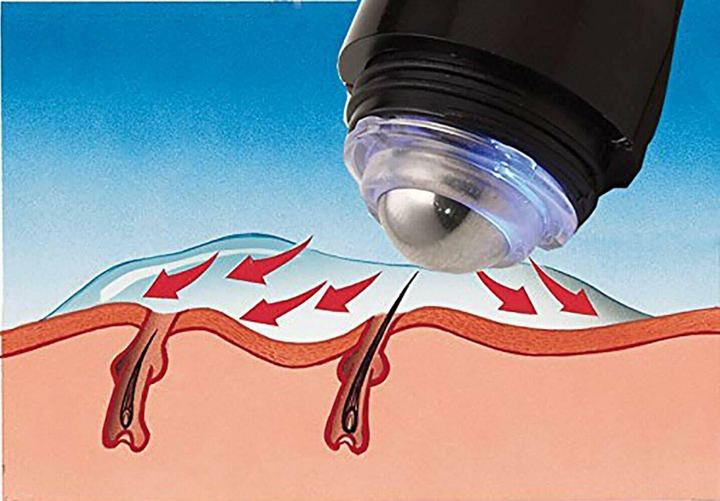 Verseo eSmooth Permanent Hair Removal Epilation System