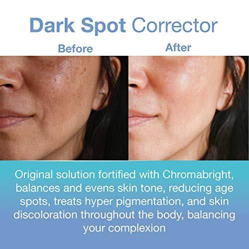 PFB Chromabright Razor Bump Stopper Skin Care Treatment, Dark Spot Remover