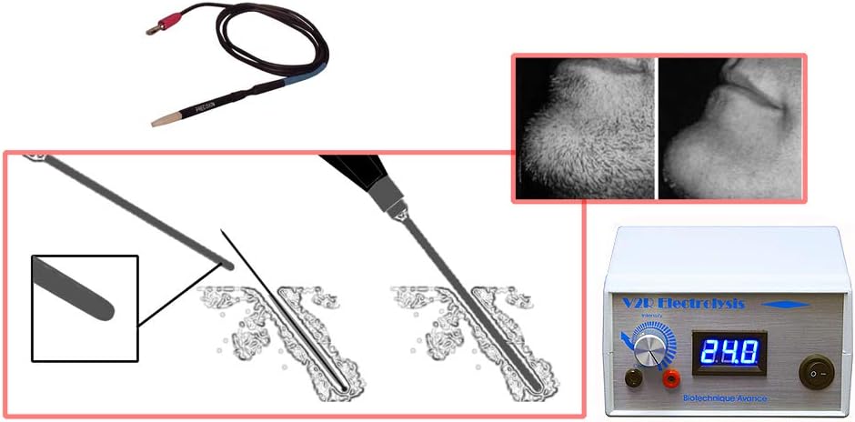 V2R Home and Professional Electrolysis System for Permanent Hair Removal Face Body
